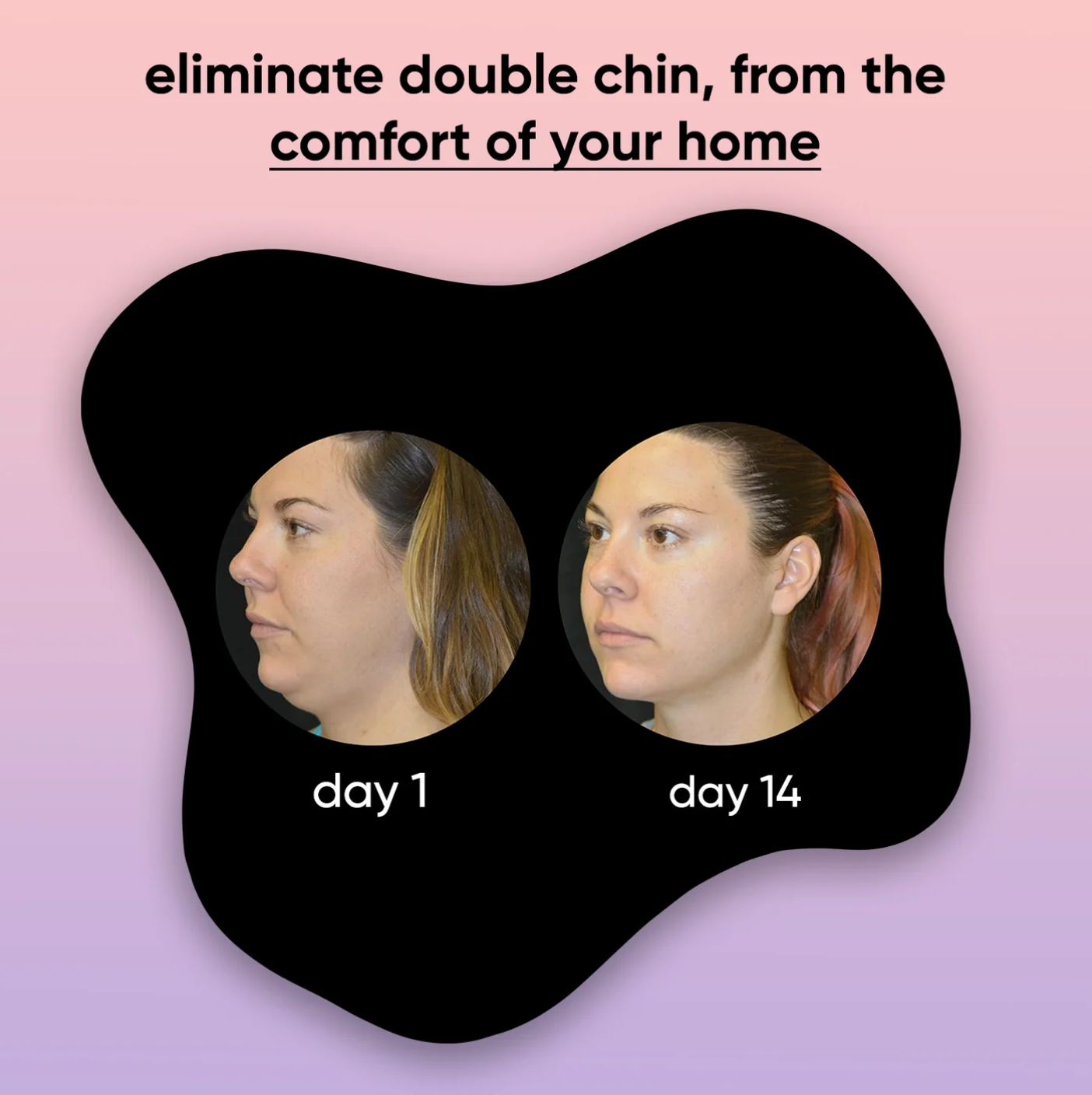 auralift - 4-in-1 facial sculptor